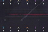 【王者赛事】 杭州LGD.NBW 3:1 上海EDG.M游戏攻略_手游下载
